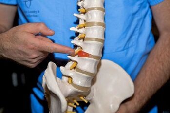 Why does the back hurts in the lower back and what to do