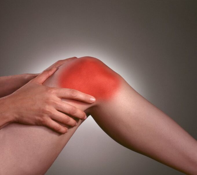 Inflammation in the knee joint with osteoarthritis