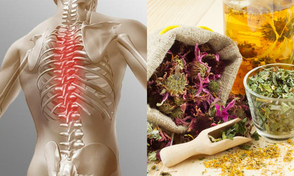 osteochondrosis of the neck traditional methods