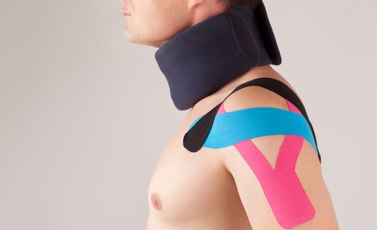 During the acute period of cervical osteochondrosis, a special collar should be worn